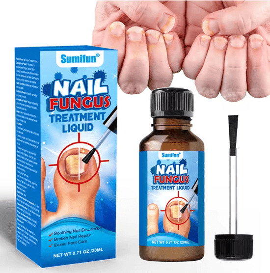 Sumifun Antifungal Nail Fungus Treatment Liquid 20ml Original